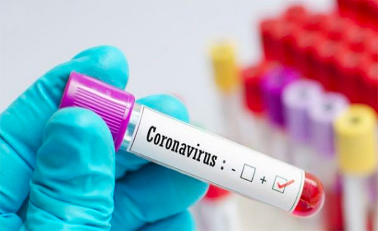 Coronavirus in Sicilia, 33 nuovi contagi