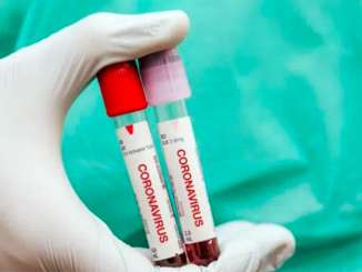 Coronavirus in Sicilia, 3.675 nuovi casi e 11 morti