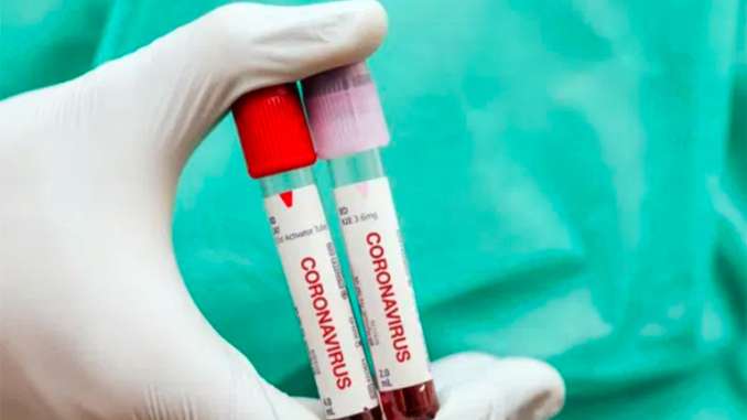 Coronavirus in Sicilia, 3.675 nuovi casi e 11 morti