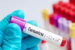 Coronavirus in Sicilia, 2.189 i nuovi casi e 23 morti
